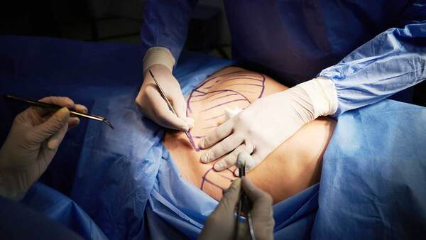 các phương pháp thẩm mỹ ngoại khoa