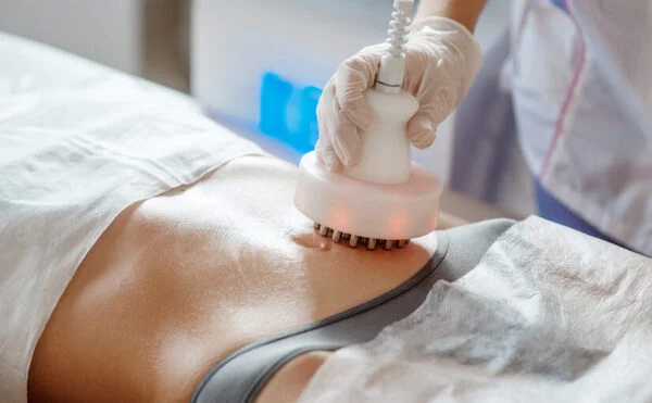 sóng vô tuyến thẩm mỹ da